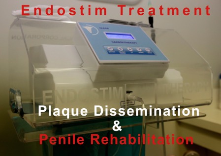 endostim