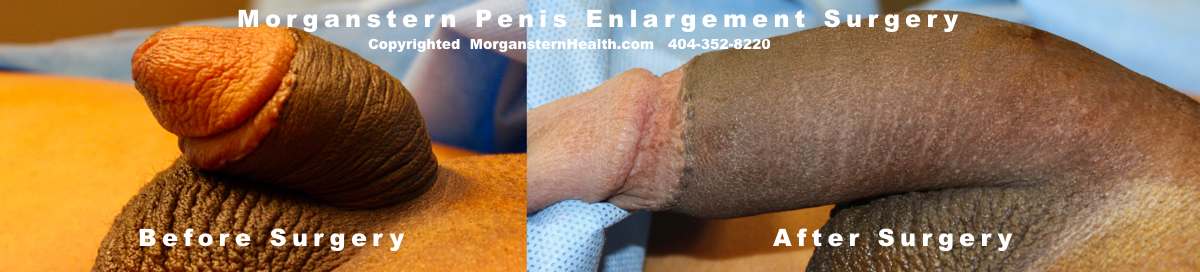 Cheap Penis Enlargement Products Best Penises Mengrnix