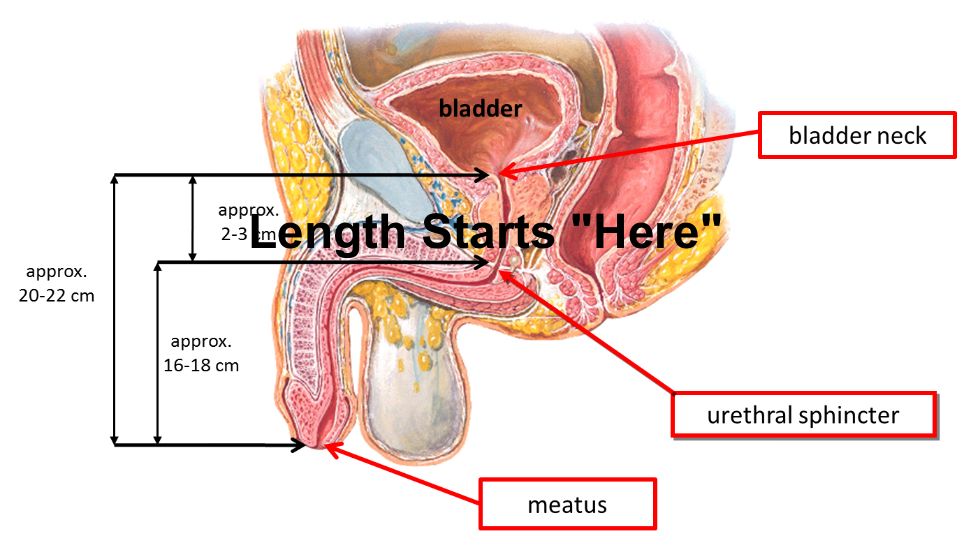 Penis Surgery Permanent Enlargement: Maximum Length Width