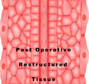 Tissue Diagram Penis Enlargement