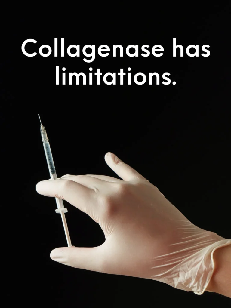 gloved hand holding a filled syringe against a black background. The text on the image reads, "Collagenase has limitations."